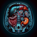 МРТ органів черевної порожнини